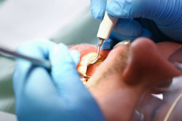 Best 24-Hour Emergency Dentist in Liberty Triangle, FL