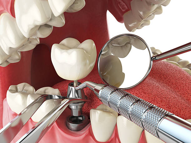 Best Emergency Dental Care for Abscessed Tooth in Liberty Triangle, FL